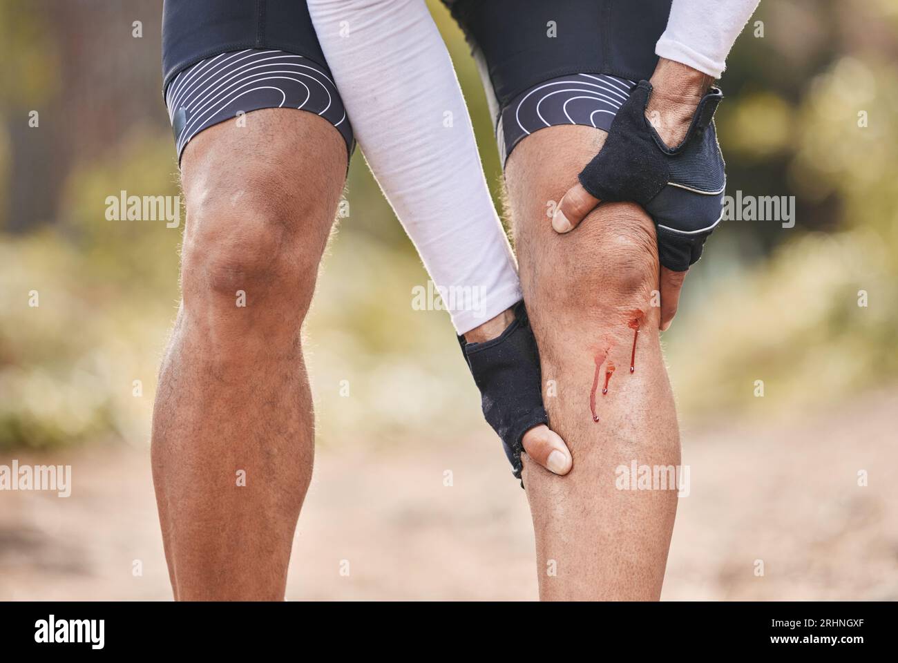 Bleeding knee cycling hi-res stock photography and images - Alamy
