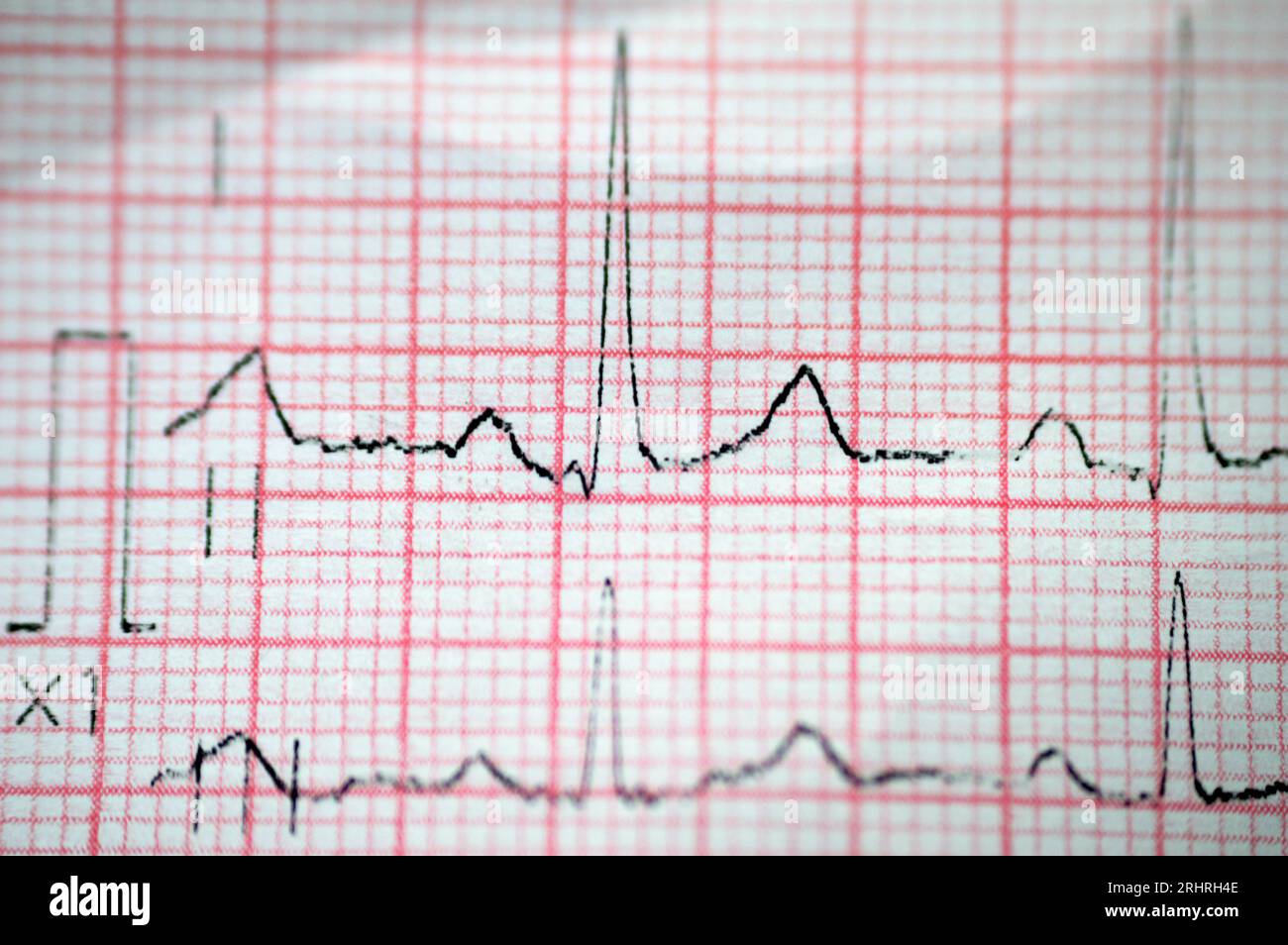 An ElectroCardioGraph ECG, a chart that draws the electricity of the ...