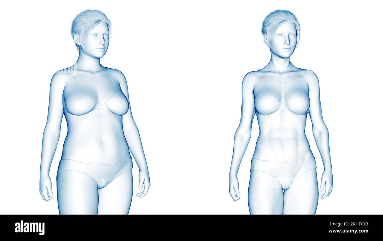 Female endomorph body type, illustration - Stock Image - F038/5688 -  Science Photo Library