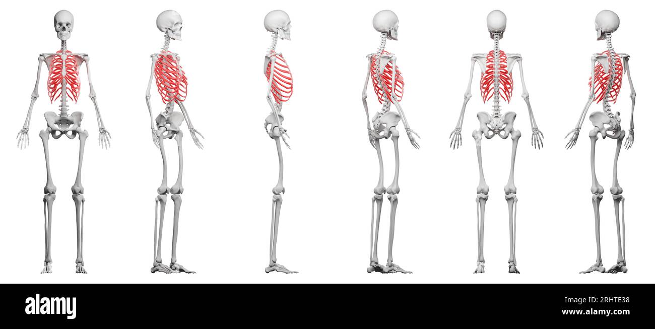 File:Antero-posterior section shape of cavities with and without corsets.gif  - Wikimedia Commons