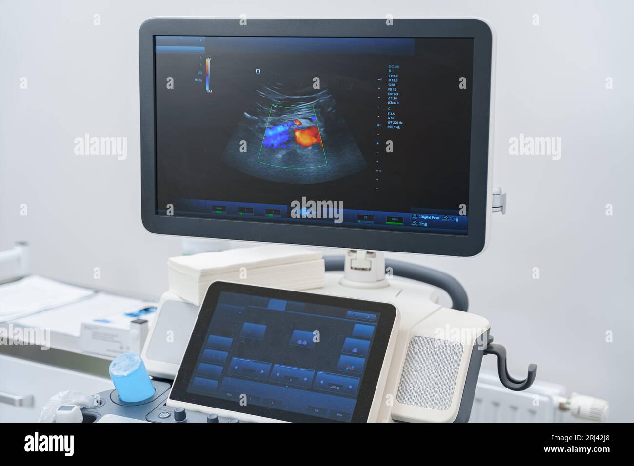 Medical ultrasound diagnostic machine is ready for work in modern
