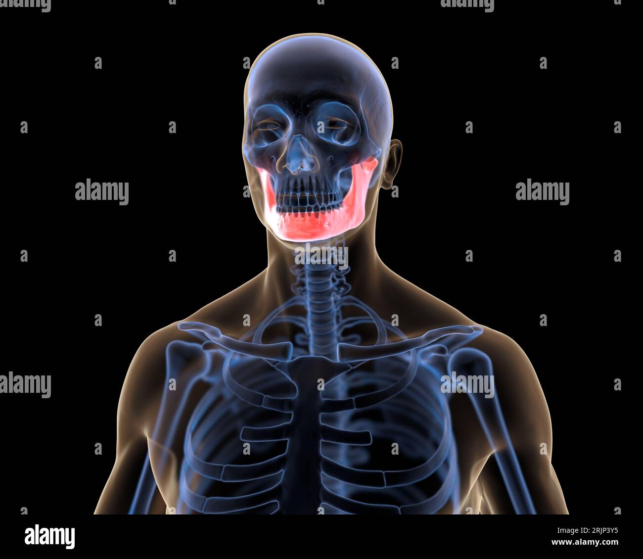 Xray Mandible in Red Highlights Stock Photo Alamy