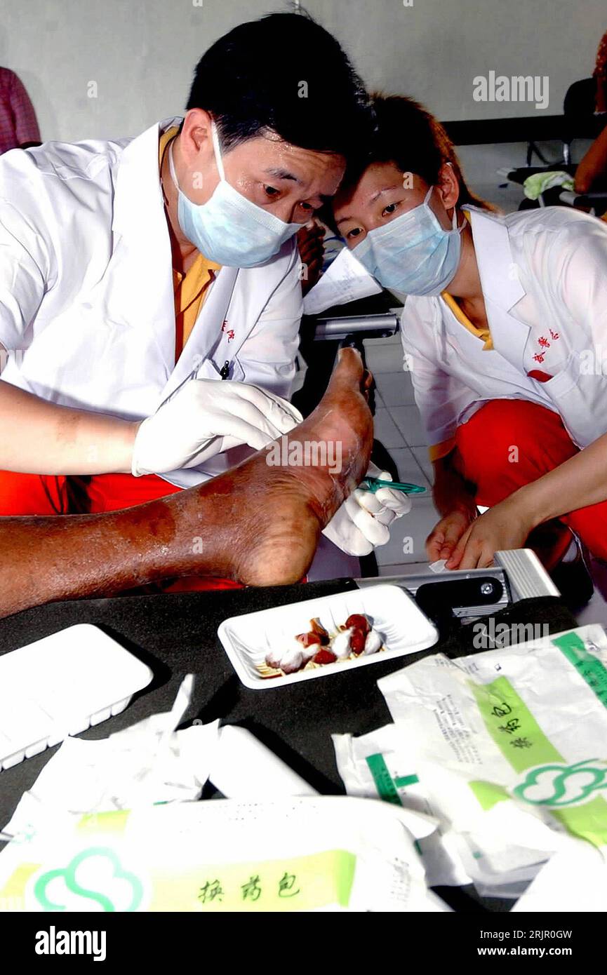 Bildnummer: 51266785  Datum: 31.05.2006  Copyright: imago/Xinhua Arzt Cai Xiaojun und die Krankenschwester Liu Wanfang (beide CHN) behandeln den geschwollenen Fuß eines Erdbebenopfers in Bantul, dem am stärksten betroffenen Stadtteil von Yogyakarta, Personen , Körperteile; 2006, Yogyakarta, Katastrophen, Katastrophe, Naturkatastrophen, Erdbeben, Folge, Folgen, Unterstützung, Erstversorgung, ärztliche Versorgung, Erste Hilfe,  Verletzter, verletzt, Verletzte, Opfer, Erdbebenopfer, Java, Beben, Krankenhäuser, Krankenhaus, Krankenstation, Krankenstationen, Ärzte, Behandlung, Behandlungen; , hoch, Stock Photo