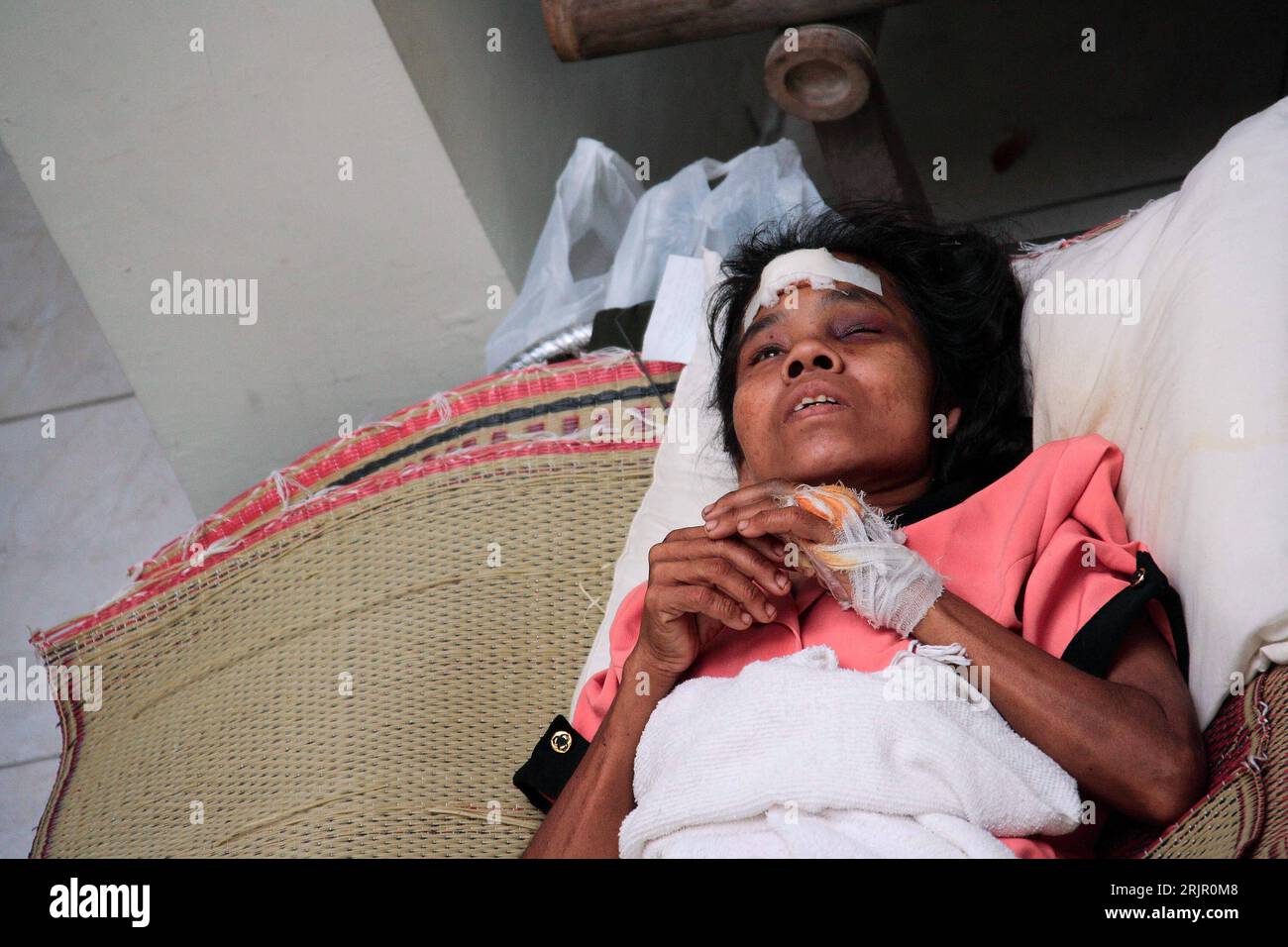 Bildnummer: 51266778  Datum: 31.05.2006  Copyright: imago/Xinhua Erdbebenopfer im Krankenhaus von Bantul, dem am stärksten betroffenen Stadtteil von Yogyakarta, Personen; 2006, Yogyakarta, Katastrophen, Katastrophe, Naturkatastrophen, Erdbeben, Folge, Folgen, Unterstützung, Erstversorgung, ärztliche Versorgung, Erste Hilfe,  Verletzter, verletzt, Verletzte, Opfer, Erdbebenopfer, Java, Beben, Krankenhaus, Krankenhäuser, Krankenstation, Krankenstationen, Verband, Verbände; , quer, Kbdig, Einzelbild, close, Indonesien,  , / pessimistisch, Leid, Frau Stock Photo