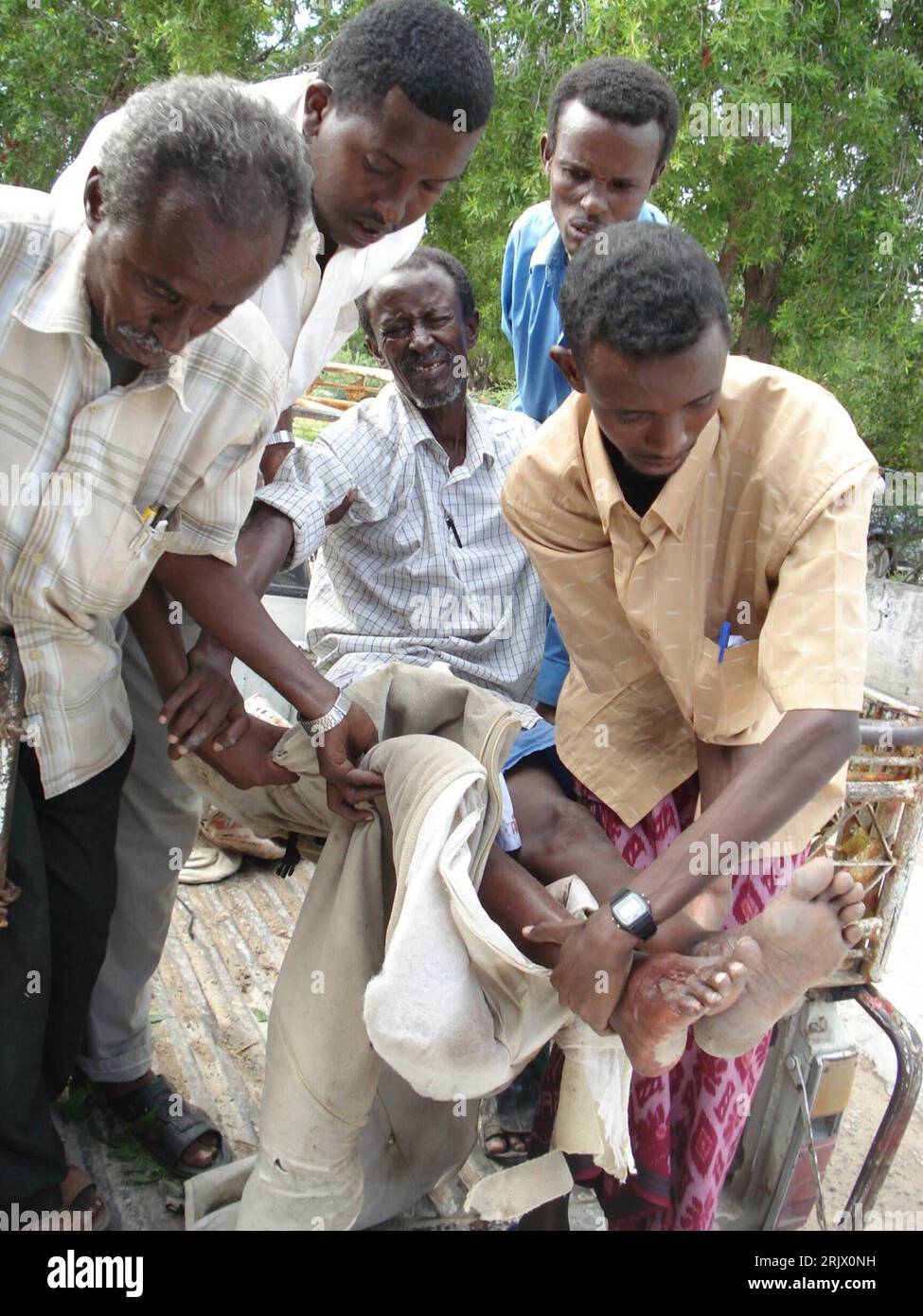 Bildnummer: 52102323  Datum: 05.09.2007  Copyright: imago/Xinhua Somalier tragen einen verletzten Mann in Mogadishu  - PUBLICATIONxNOTxINxCHN, Personen; 2007, Mogadishu, Verletzung, Verletzungen, verletzt, verletzte, verwundet, verwundeter, verwundete, Somali, Somalis; , hoch, Kbdig, Gruppenbild, Somalia,  o0 Bürgerkrieg, Opfer Stock Photo