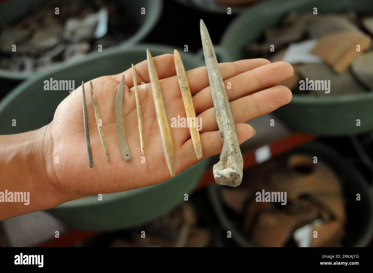 Bone spicules hi-res stock photography and images - Alamy