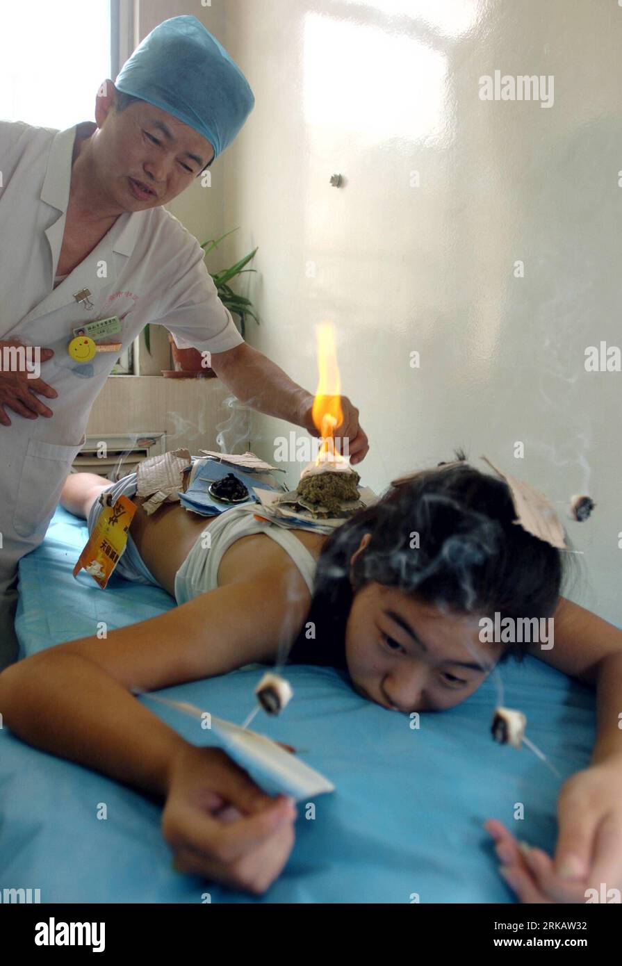 Acupuncture patient chinese history hi-res stock photography and images ...