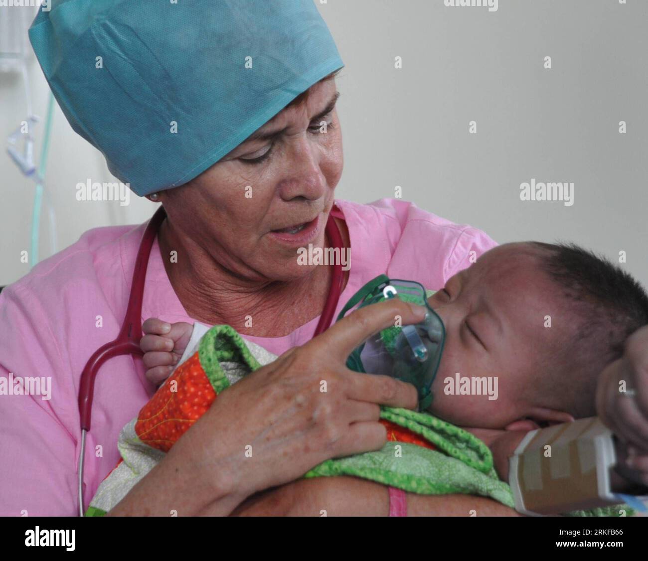 Cleft palate repair hi-res stock photography and images - Alamy