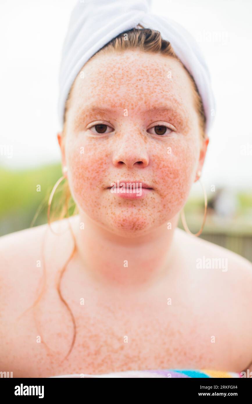 Fresh Freckled face Gen Z Beauty Portrait Stock Photo Alamy