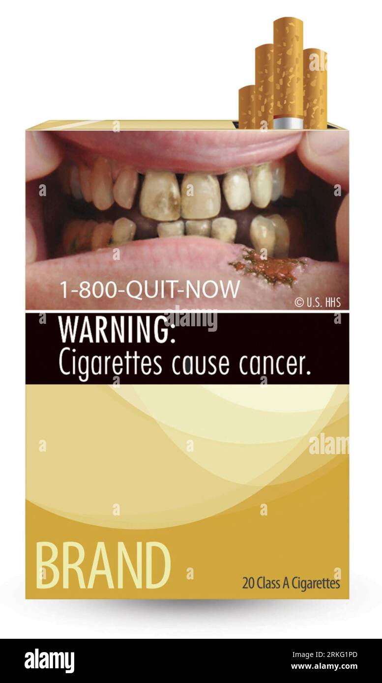 Bildnummer: 55532424  Datum: 22.06.2011  Copyright: imago/Xinhua (110621) -- WASHINGTON, June 21, 2011 (Xinhua) -- Picture provided by the U.S. Food and Drug Administration (FDA) on June 21, 2011 shows a graphic cigarette warning label. FDA on Tuesday unveiled nine graphic cigarette warning labels that highlight the dangers of smoking, in an effort to help prevent children from smoking, encourage adults who do to quit. (Xinhua) (wjd) US-FDA-CIGARETTE-WARNING LABEL PUBLICATIONxNOTxINxCHN Gesellschaft Rauchen Warnung Zigaretten Zigarettenschachtel Gefahren Gesundheitsschäden Schäden Gesundheit x Stock Photo