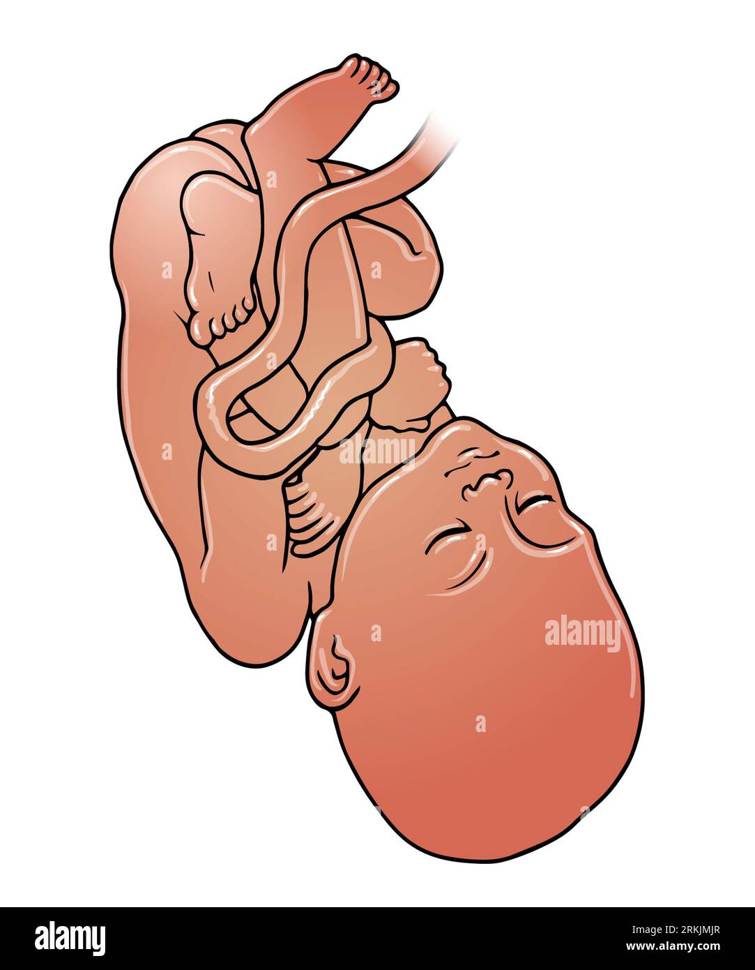 Art illustration of dark skinned foetus, baby in cephalic presentation delivery position, which can occur between 32-36 weeks, pregnancy, child birth Stock Photo