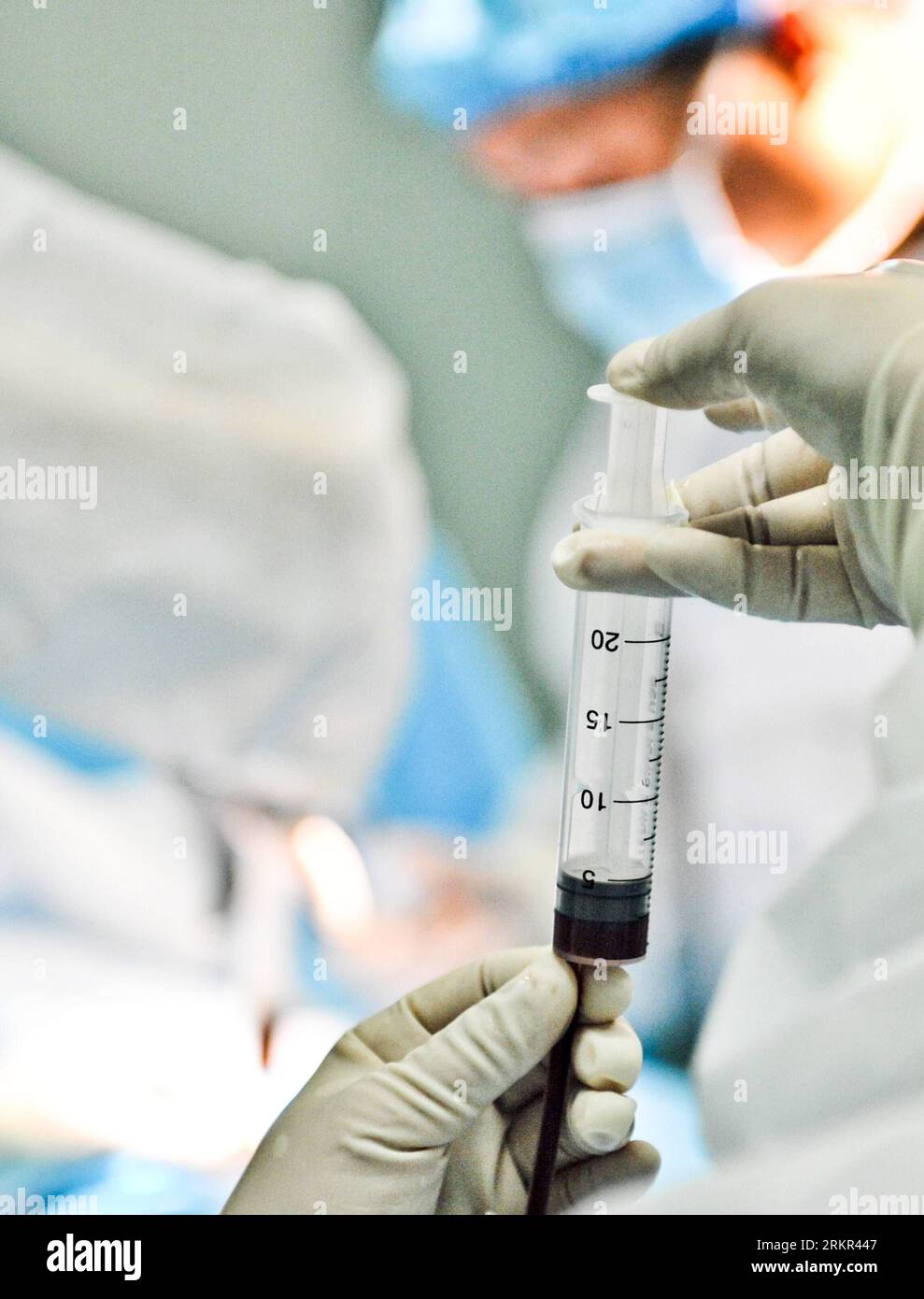 Bildnummer: 58115365  Datum: 18.06.2012  Copyright: imago/Xinhua (120618) -- CHONGQING, June 18, 2012 (Xinhua) -- A doctor injects stem cells withdrawn from the prisoner father surnamed Gao into a storage container at Xinqiao Hospital in Chongqing, southwest China, June 15, 2012. A family is facing an anxious wait to see whether a bone marrow transplant, made possible by the incarcerated father s rare trans-provincial prison transfer, has saved their son s life. PUBLICATIONxNOTxINxCHN Gesellschaft Fotostory Leukämie Medizin Knochenmarkspende Stammzellen Stammzellentherapie Spende xjh x2x 2012 Stock Photo