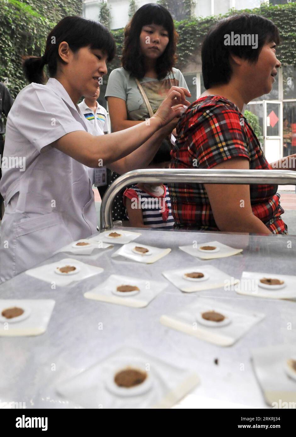 Bildnummer: 58254297  Datum: 18.07.2012  Copyright: imago/Xinhua (120718) -- ZHENGZHOU, July 18, 2012 (Xinhua) -- A doctor sticks the Sanfu Paste on the back of a citizen at a hospital in Zhengzhou, capital of central China s Henan Province, July 18, 2012. The Sanfu Paste, also known as dog-days paste, is a traditional Chinese medicine treatment. During the treatment, patients will be stuck with the Chinese medicine contained in the paste on acupoints during the dog days, the hottest and most sultry days of summer. This treatment is regarded to be able to cure such chronic diseases like asthma Stock Photo