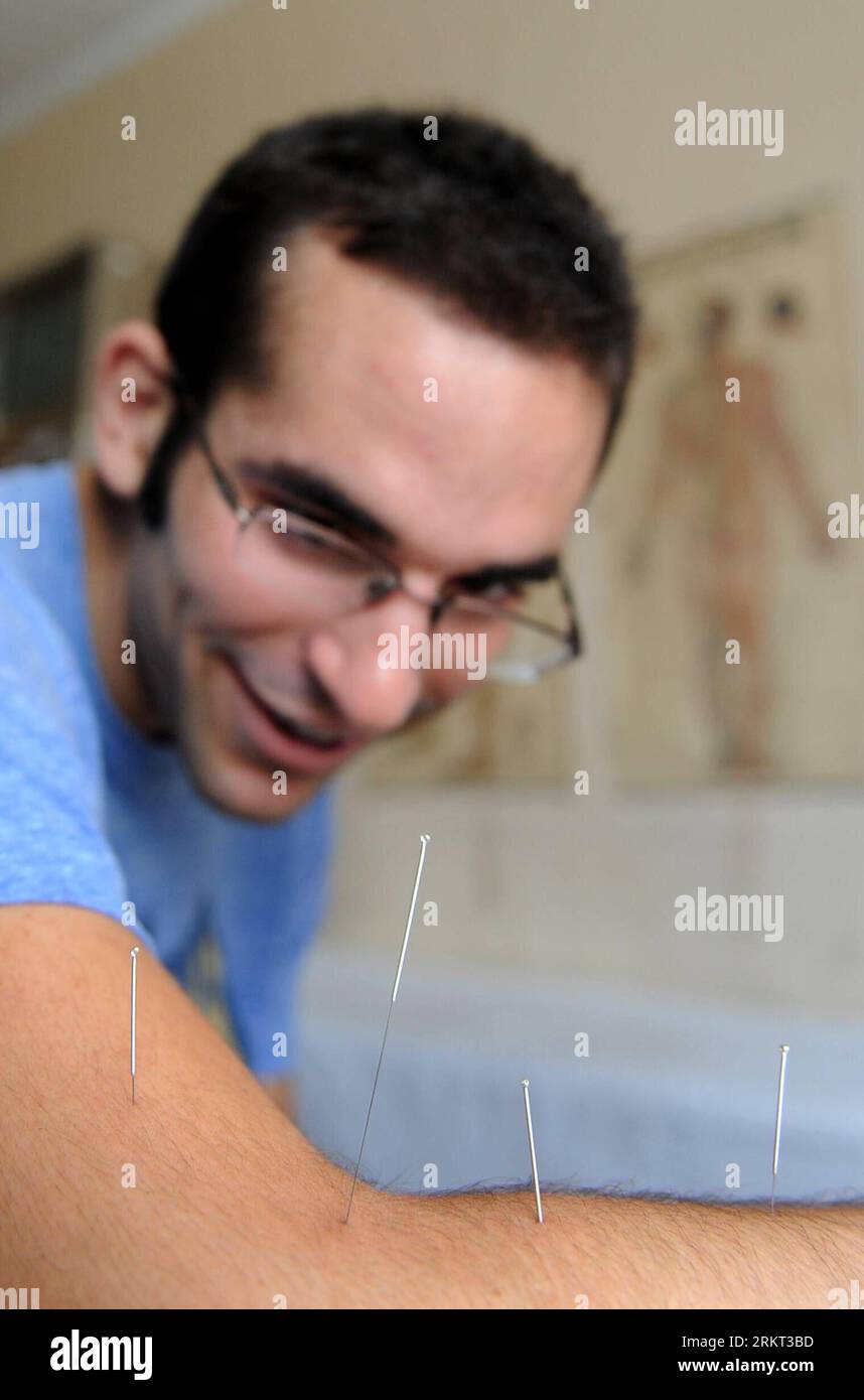 Chinese acupuncture student hi-res stock photography and images - Alamy