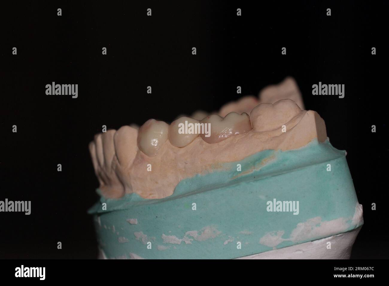 Fixed smile hi-res stock photography and images - Alamy