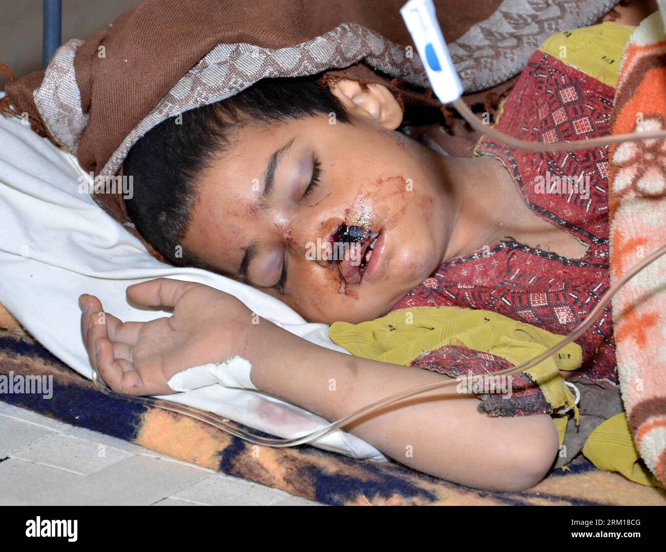 Bildnummer: 59536897  Datum: 17.04.2013  Copyright: imago/Xinhua (130418) -- MASHKEL, April 18, 2013 (Xinhua) -- An injured Pakistani kid is treated at a military field hospital in the quake-hit area of southwest Pakistan s Mashkel on April 17, 2013. The Pakistani authorities on Thursday said that rescue operations had been sped up in areas affected by the Tuesday s 7.9 magnitude earthquake in the country s southwestern province of Balochistan near Pak-Iran border. According to the official figures, at least 40 were killed and over 300 others injured when tremors jolted the Mashkel area of Was Stock Photo