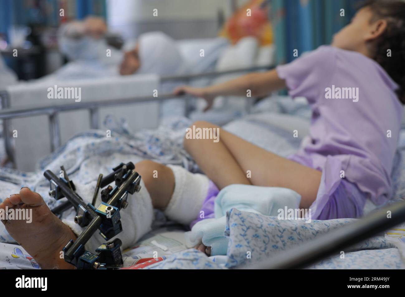 Shrapnel wounds hires stock photography and images Alamy