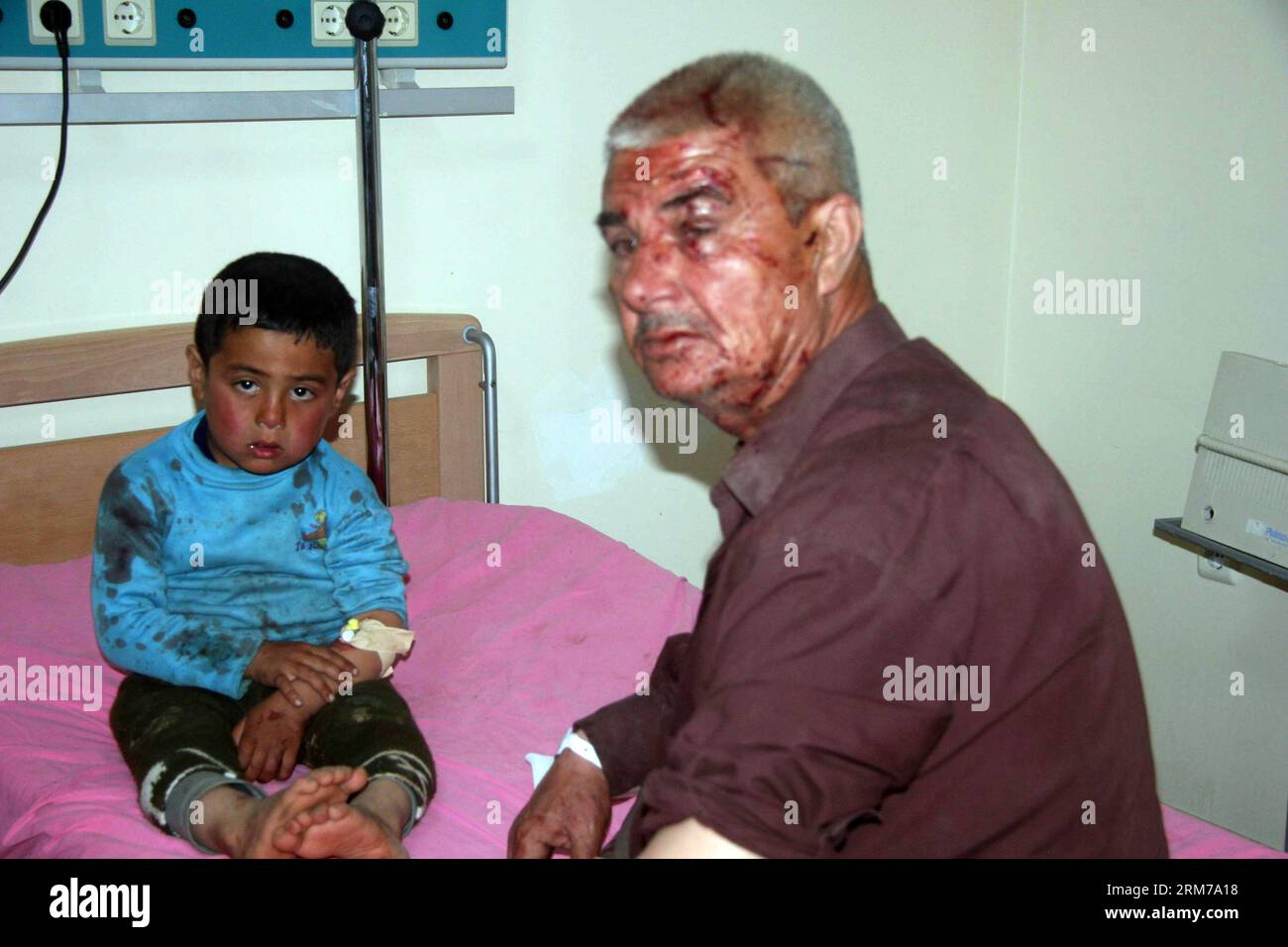 (140220) -- KILIS(TURKEY), Feb. 20, 2014 (Xinhua) -- Wounded people wait for medical treatment at a hospital in southern Turkish province of Kilis, Feb. 20, 2014. At least 24 people were killed and many others wounded on Thursday in a strong explosion near Syrian- Turkish border in Kilis province in southern Turkey, private Dogan news agency reported. (Xinhua/Mert Macit) TURKEY-KILIS-SYRIAN BORDER-BLAST PUBLICATIONxNOTxINxCHN   Turkey Feb 20 2014 XINHUA Wounded Celebrities Wait for Medical Treatment AT a Hospital in Southern Turkish Province of  Feb 20 2014 AT least 24 Celebrities Were KILLED Stock Photo