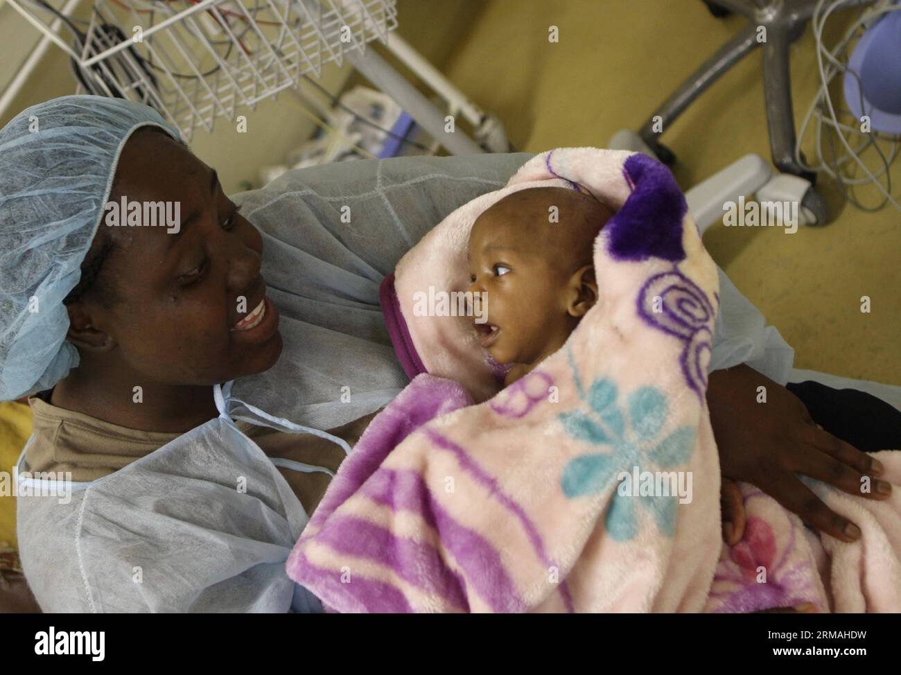 A Zimbabwean nurse takes in her arms one of the conjoined twins after a