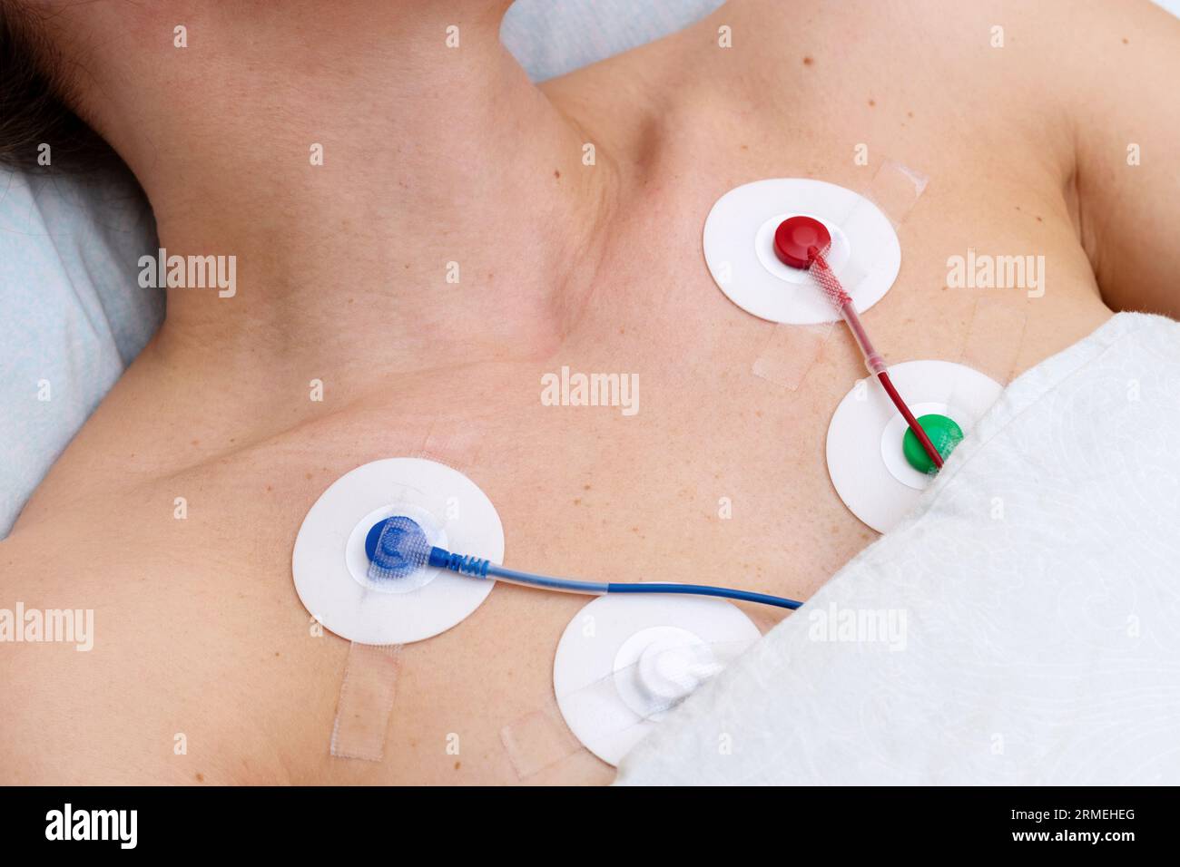 Holter monitoring nobody of patient. Stock Photo
