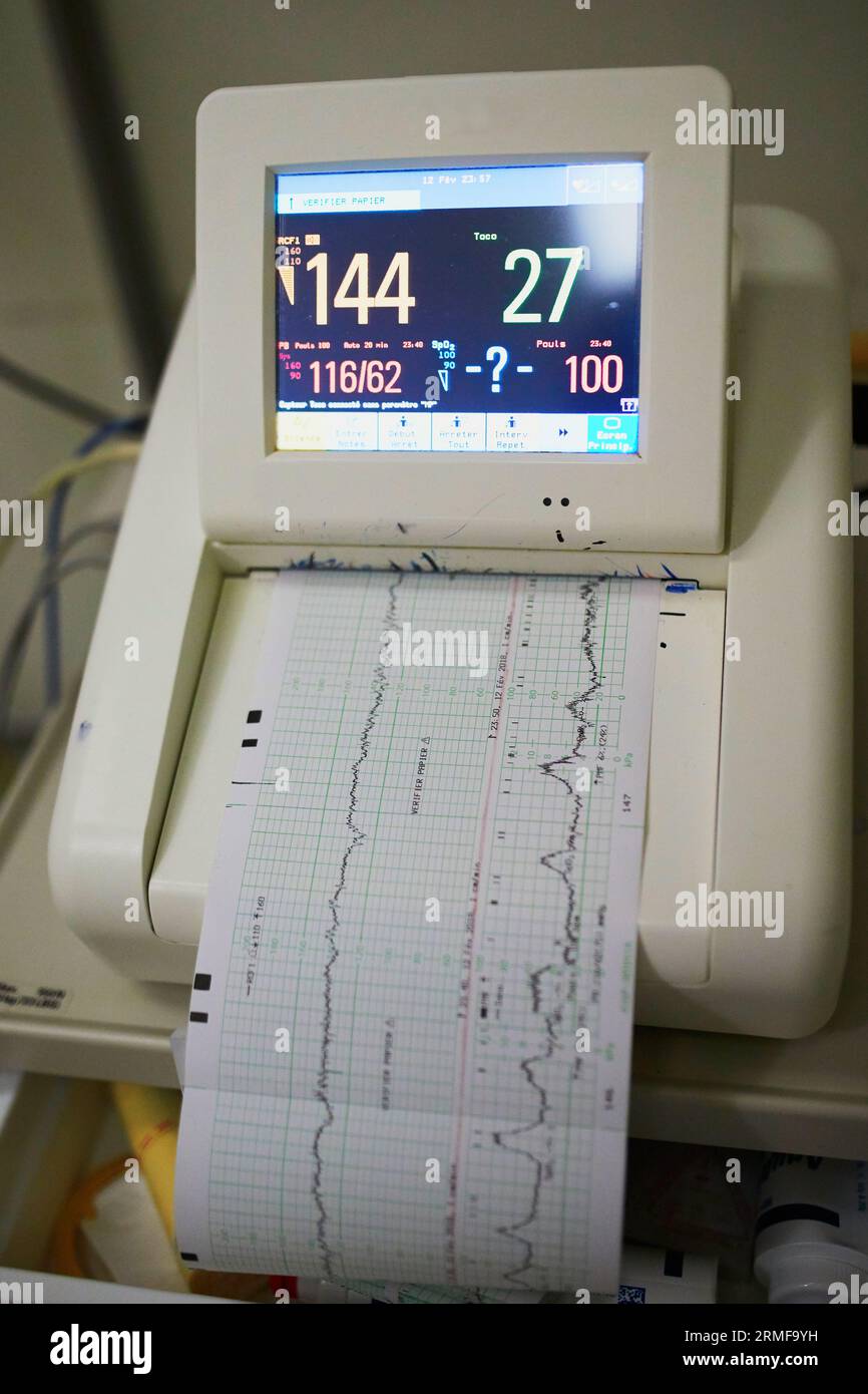 Cardiotocograph recording fetal heart rate and uterine contractions Stock Photo