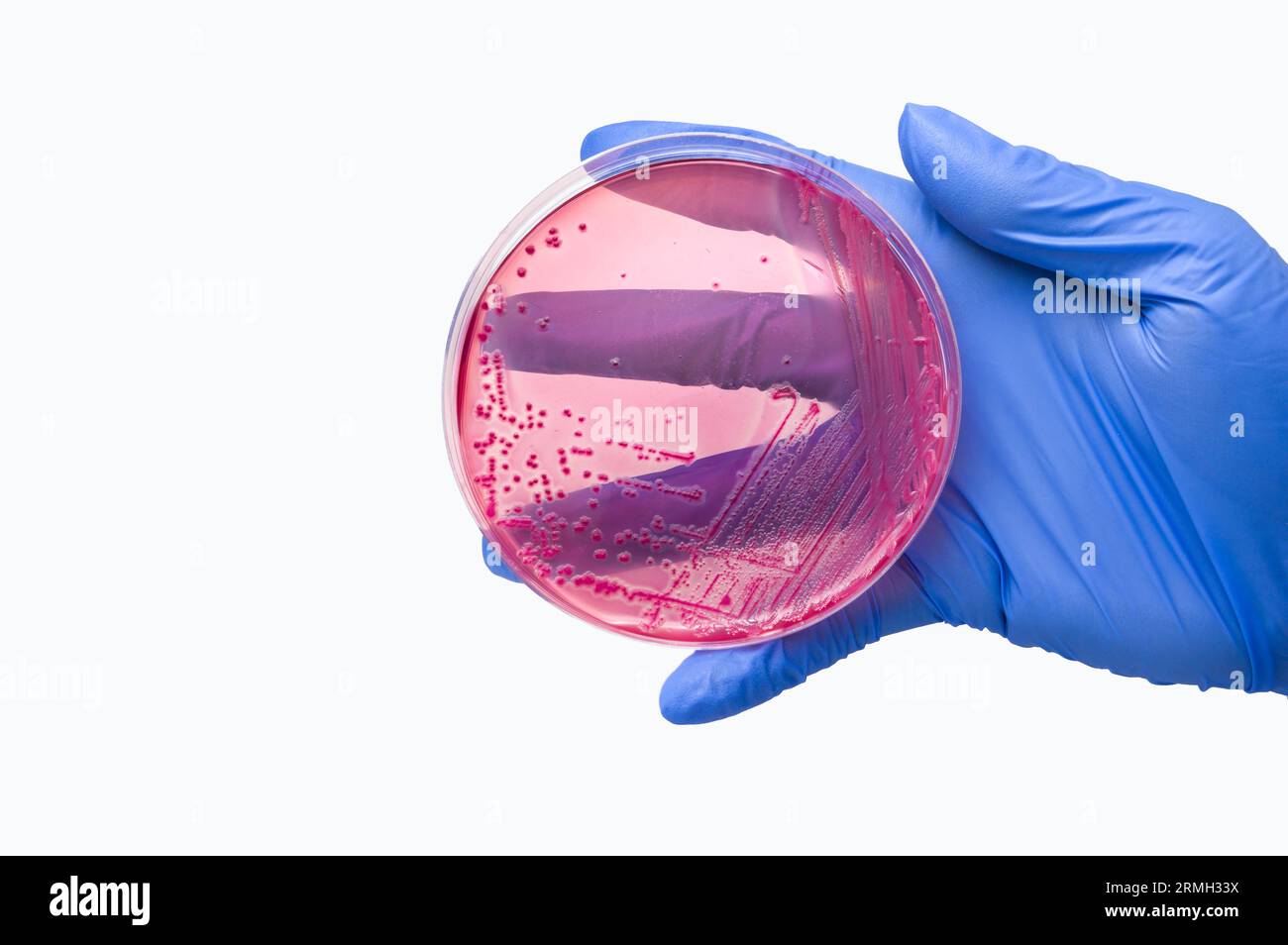 gloved hand holds petri dish with Escherichia coli colonies on MacConkey agar, inoculated by streaking metod Stock Photo