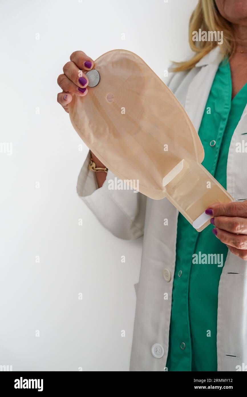 a female doctor showing a ileostomy bag after a colon cancer in a