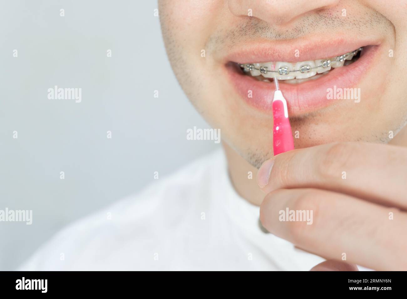 Handsome young man with beautiful white teeth with brackets cleaning his teeth with dental brush stick close up copy space. handsome young man with de Stock Photo