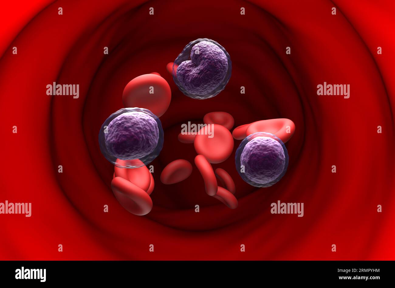 Non-hodgkin lymphoma NHL cells in the blood flow - section view 3d ...