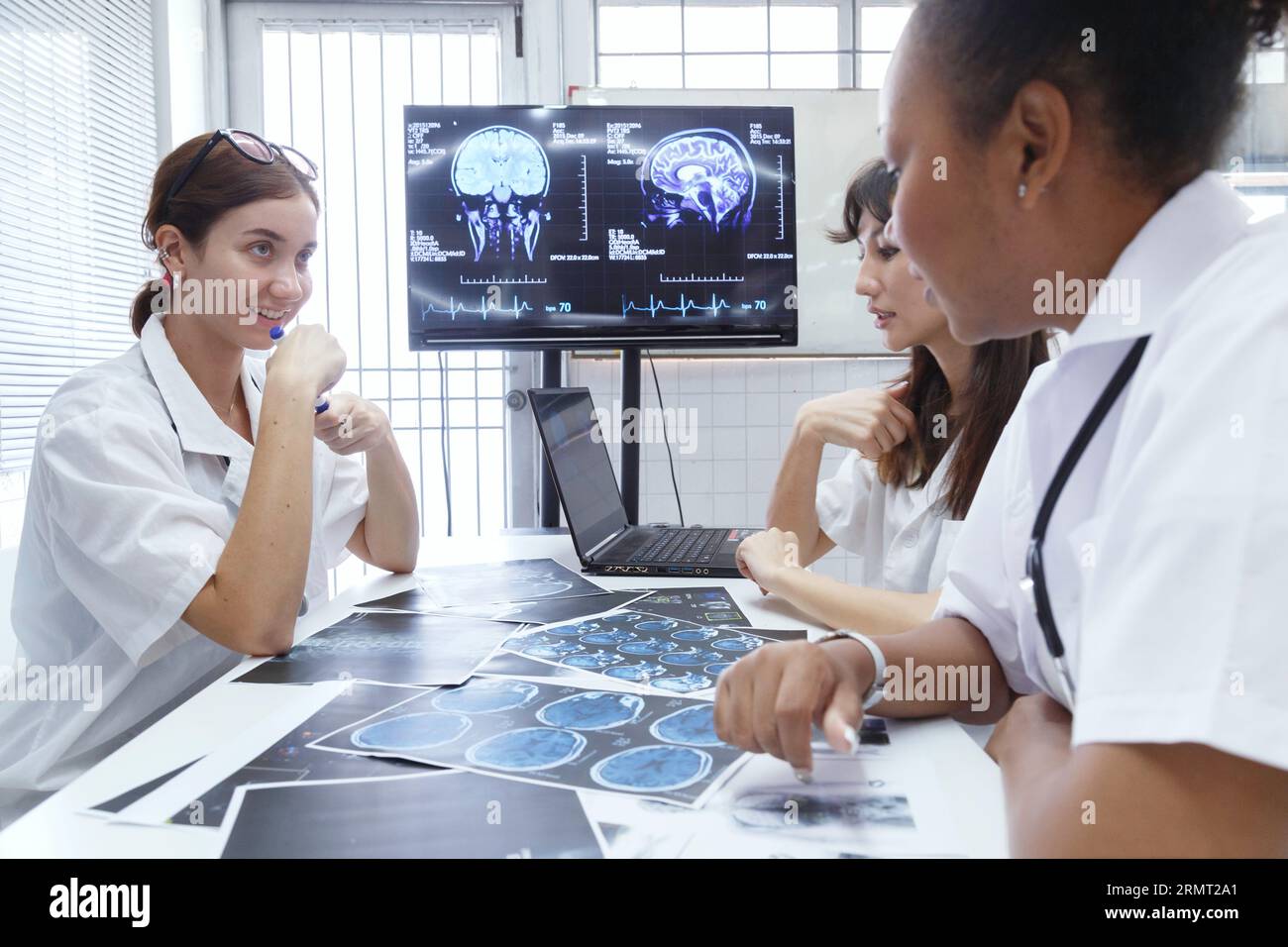 young female doctor student internship team group meeting and discussing about brain cancer surgery treatment patient case at the lab office in hospit Stock Photo