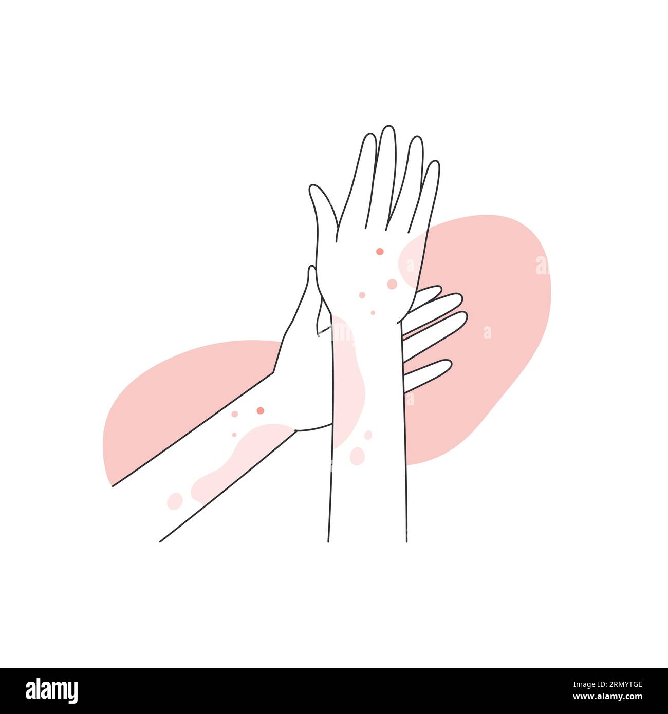 Human hands covered with red rash. Allergic reaction on hands, atopic dermatitis line vector illustration Stock Vector