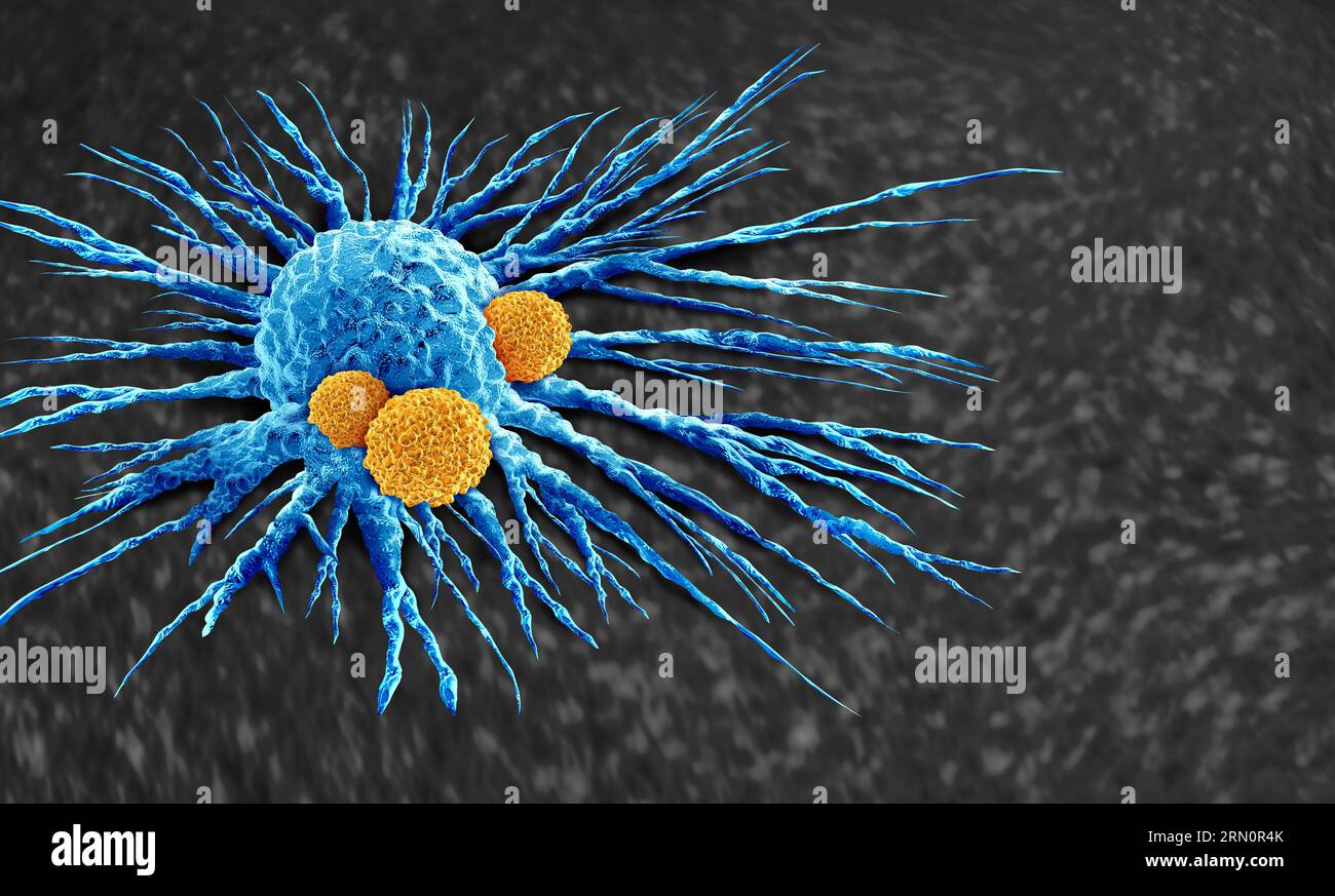 Cancer killing Cells and tumor Spread and oncology or Malignant Cancerous Growth and Metastasis anatomy concept as growing Malignancy disease Stock Photo