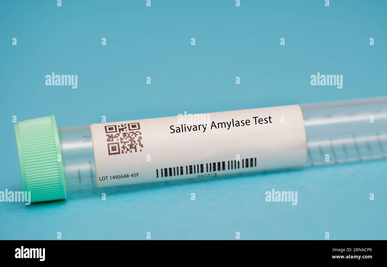Salivary Amylase Test This test measures the levels of amylase, an