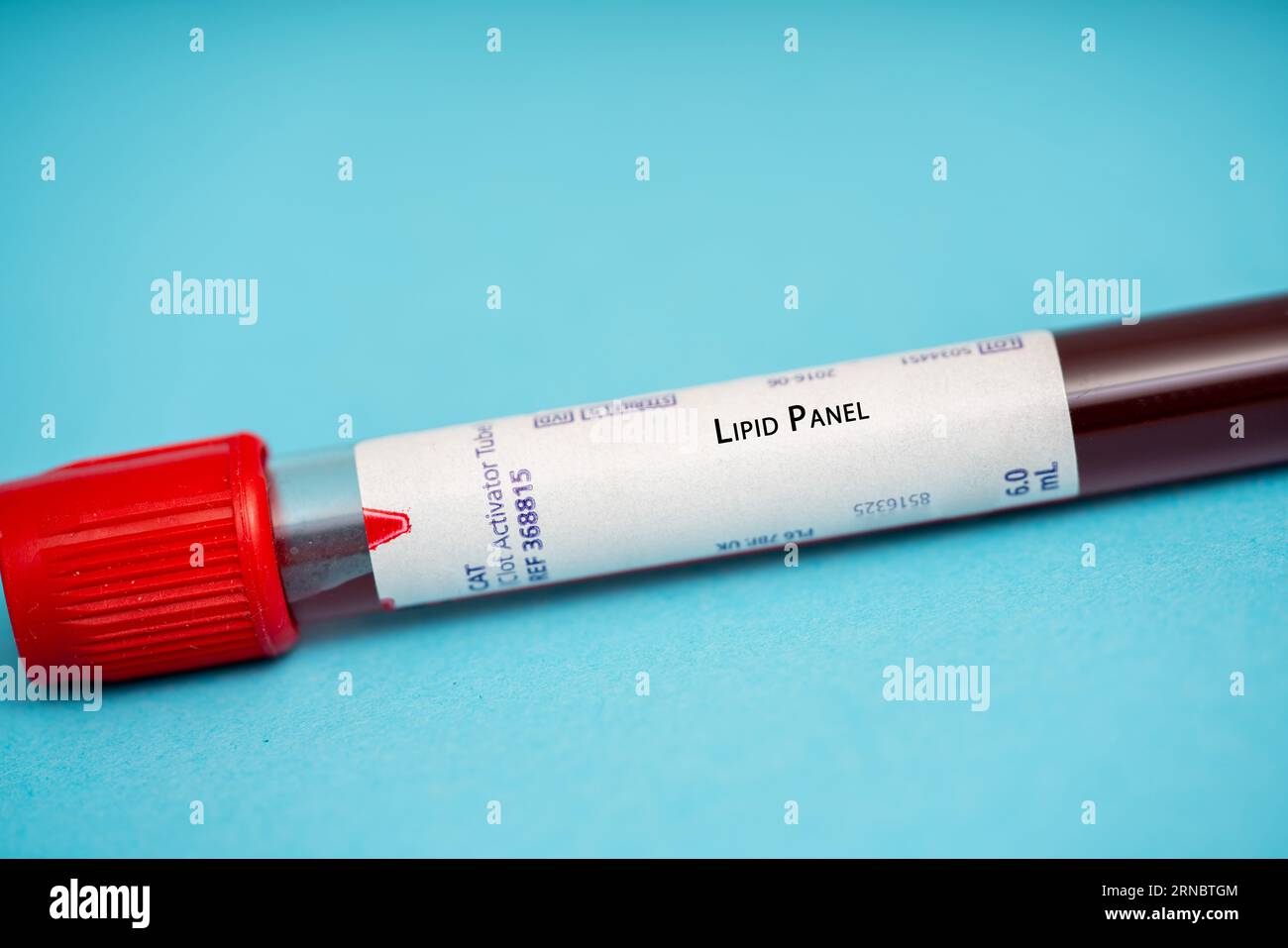 Lipid panel this test measures cholesterol levels including total