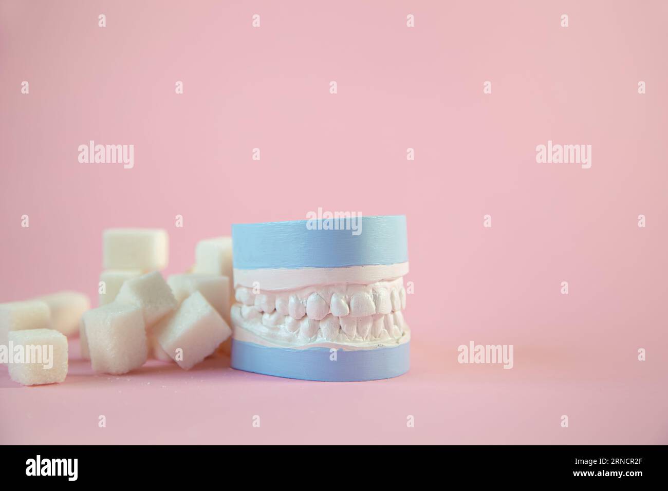 plaster-model-of-the-jaw-with-sugar-cubes-on-a-pink-background-sweets