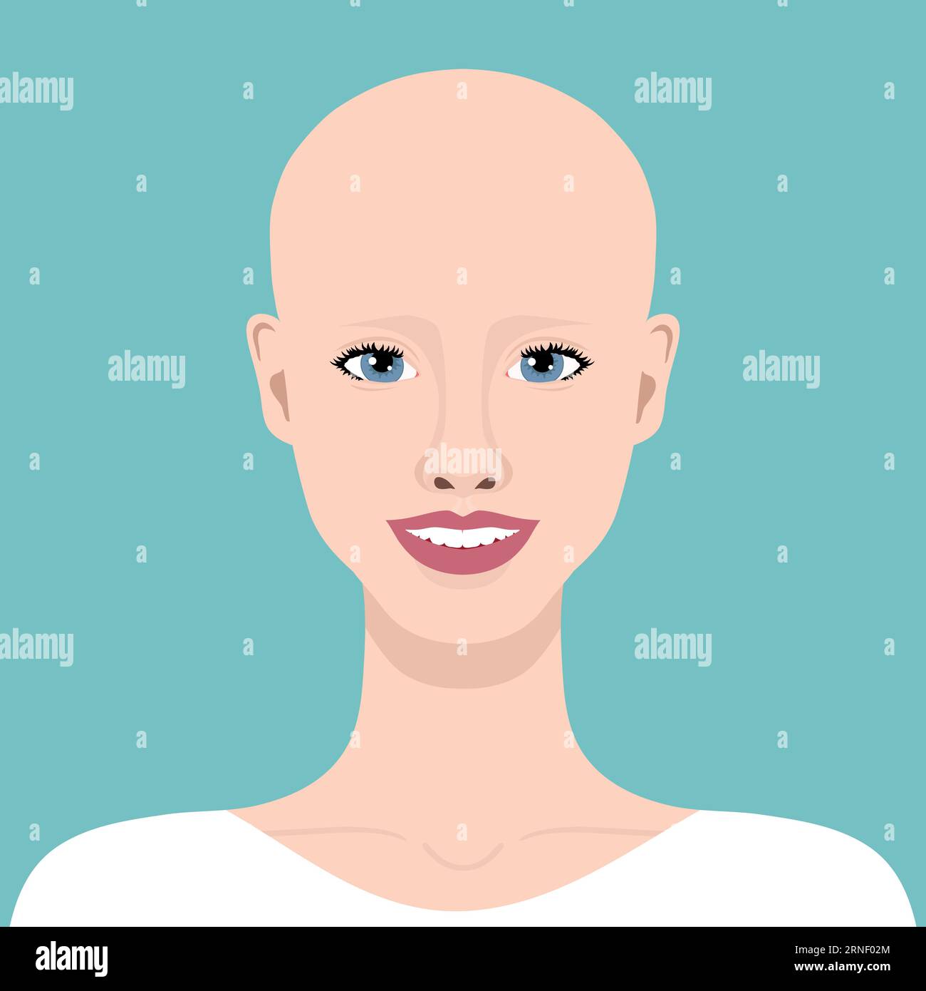 Young smiling woman with alopecia. Beautiful bald girl. Alopecia areata. Vector illustration Stock Vector