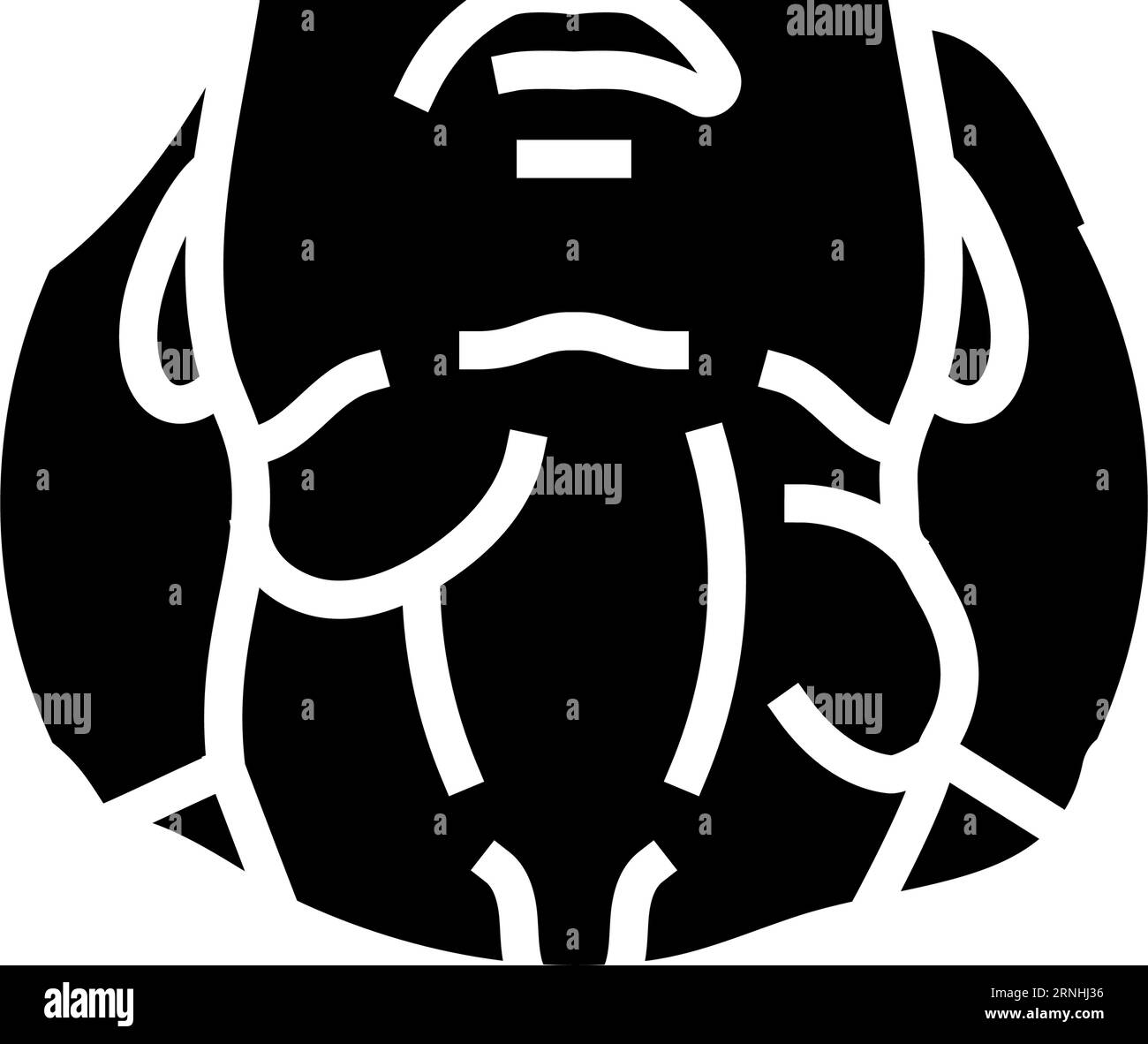 Swollen lymph nodes Black and White Stock Photos & Images - Alamy