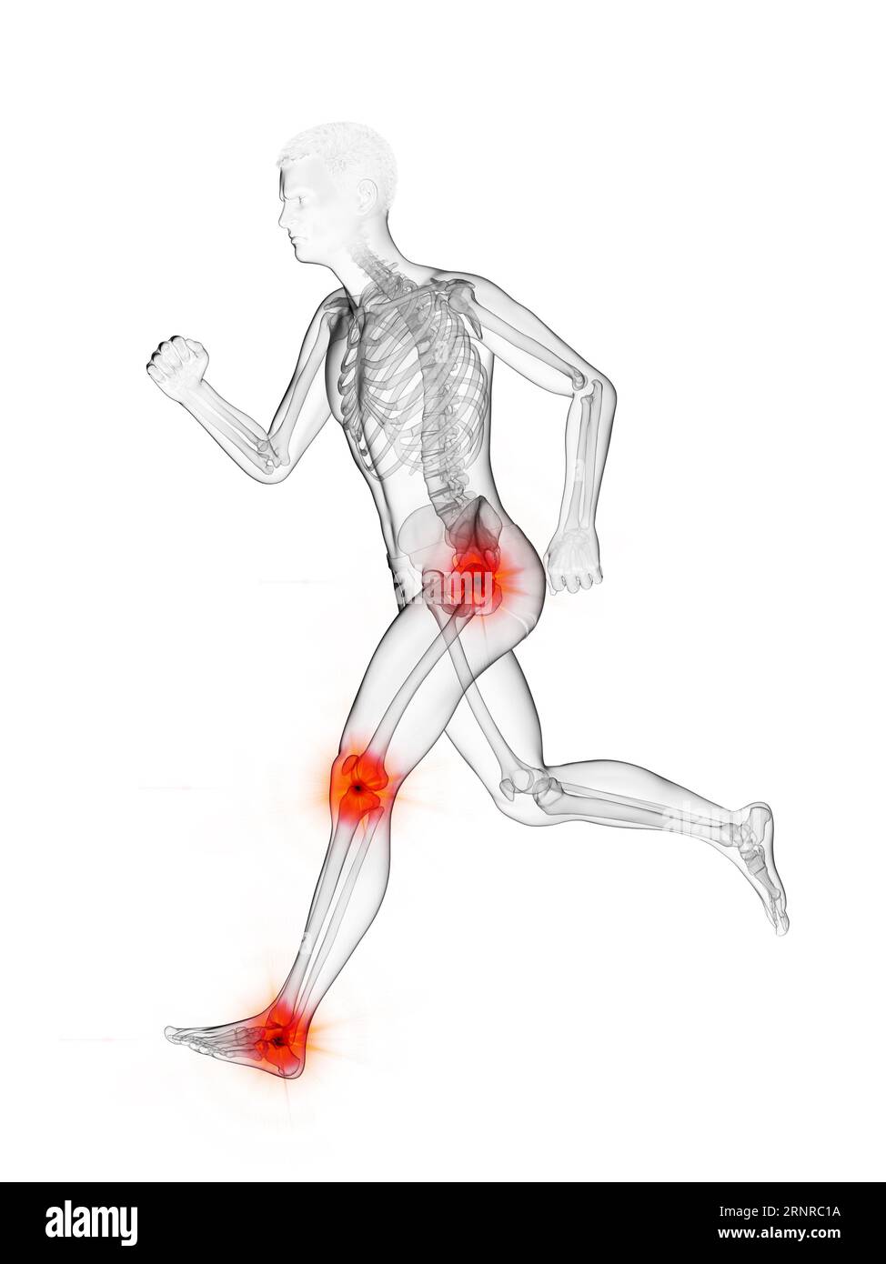 Runner's painful joints, illustration Stock Photo Alamy