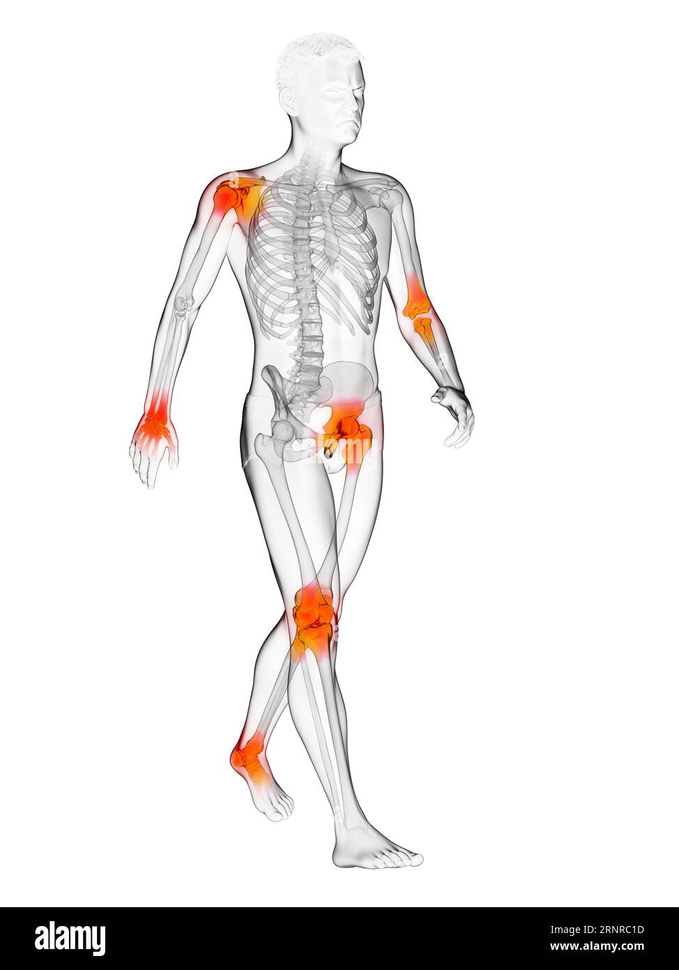 Painful joints, illustration Stock Photo Alamy