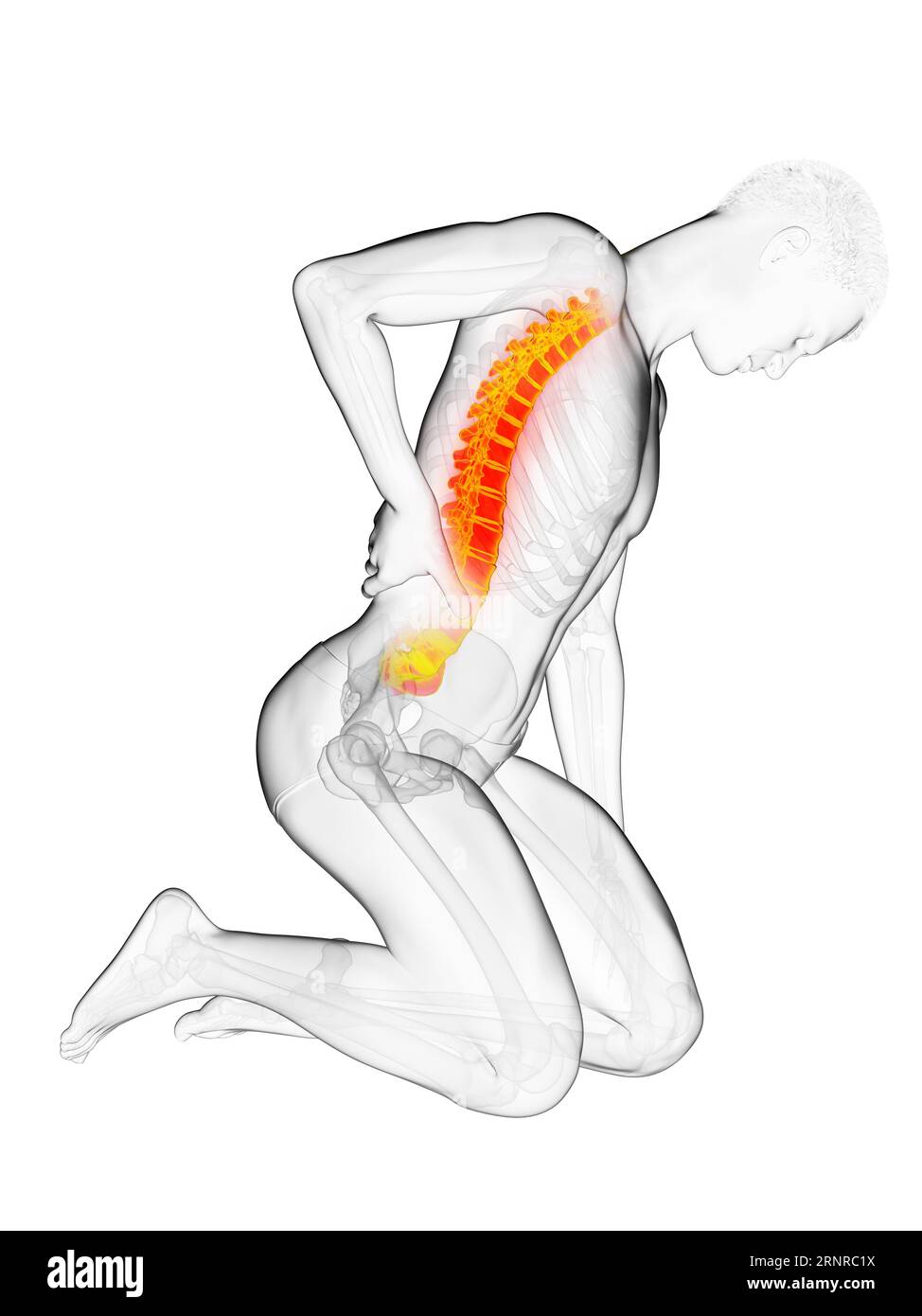 Man with acute back pain, illustration Stock Photo - Alamy