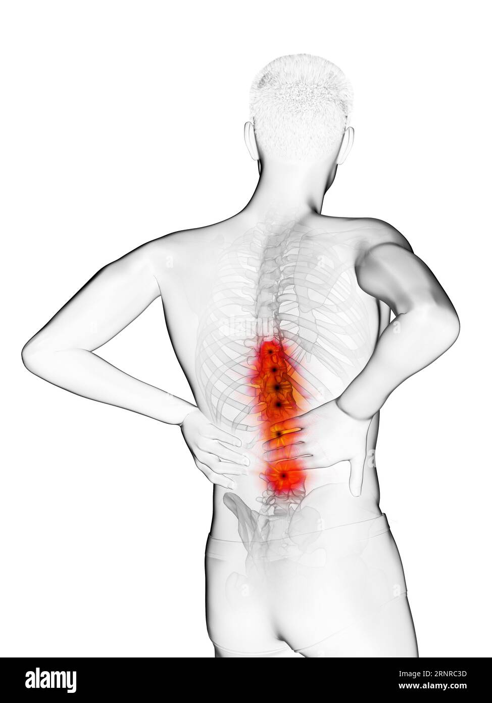 Man with backache, illustration Stock Photo - Alamy