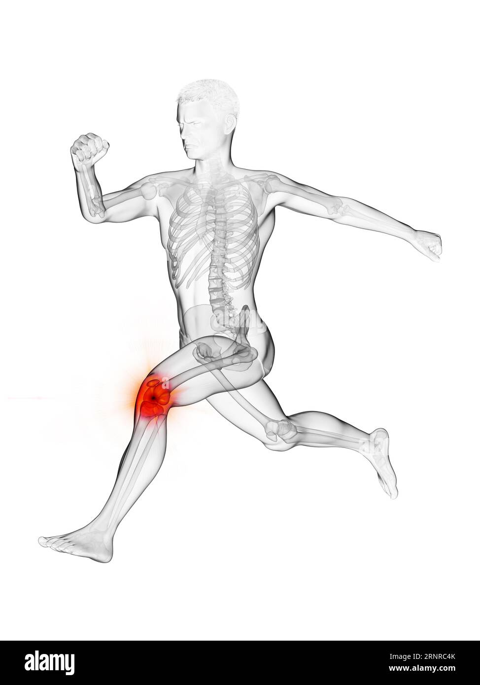 Runner Pain Runners knee joint hi-res stock photography and images - Alamy