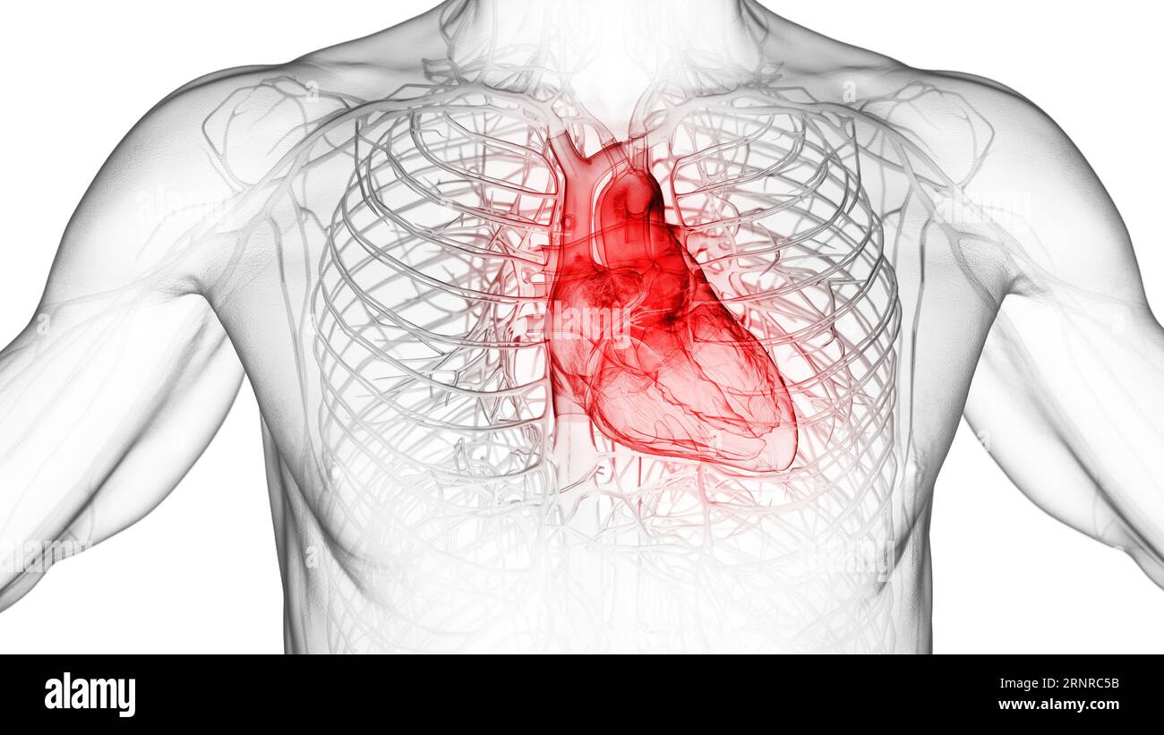 Inflamed heart, illustration Stock Photo - Alamy