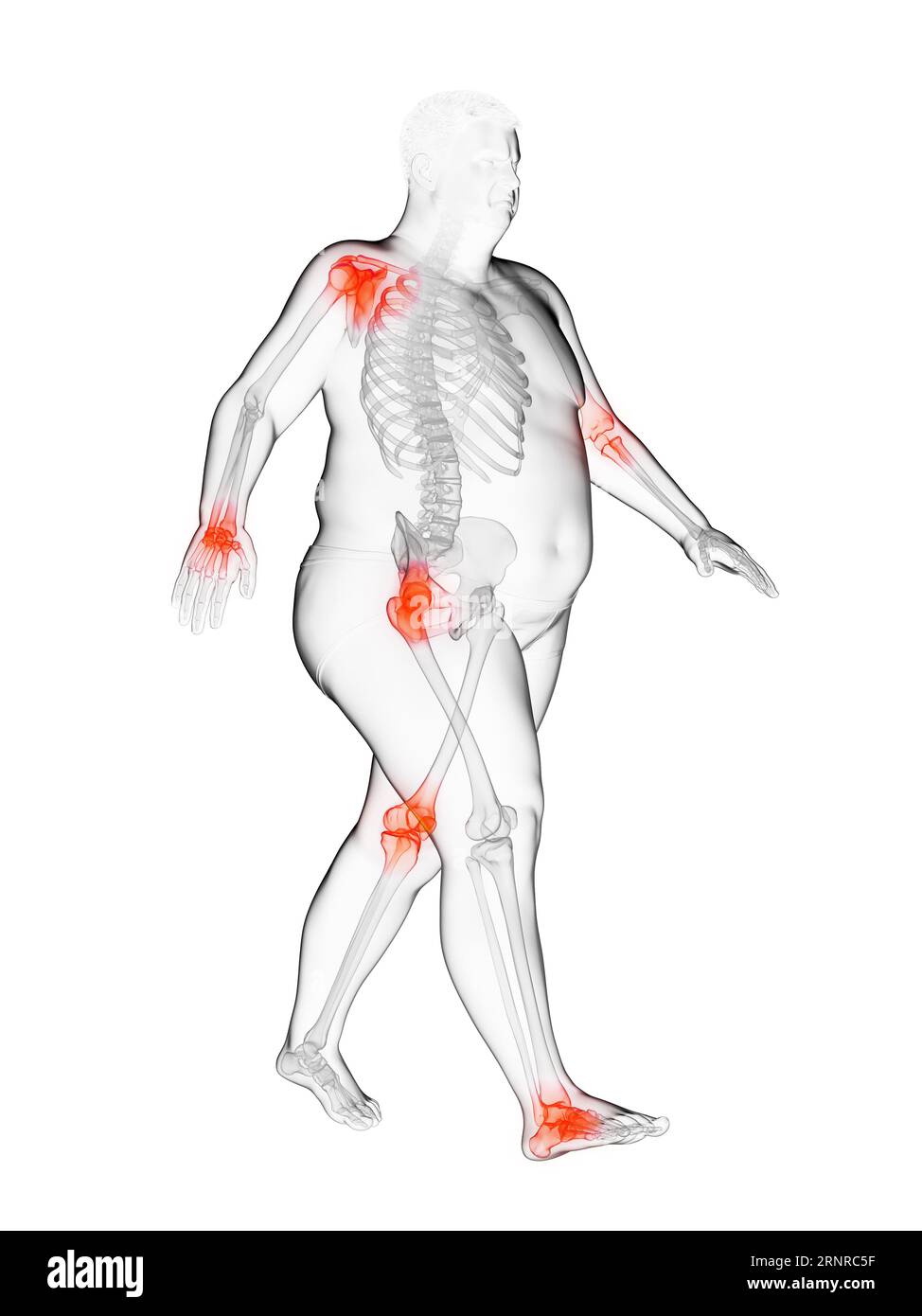 Obese Man s Painful Joints Illustration Stock Photo Alamy obese-man-s-painful-joints-illustration-stock-photo-alamy