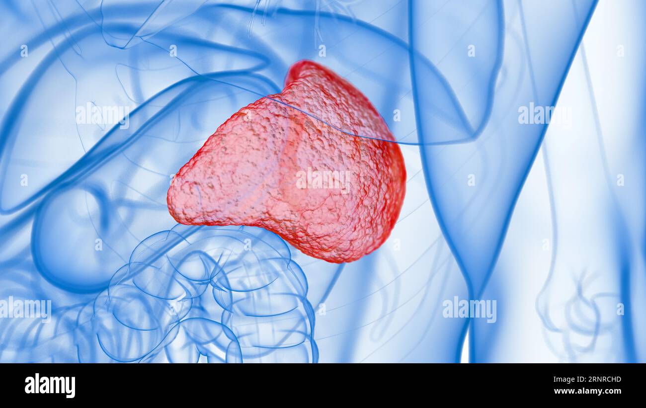 Inflamed spleen, illustration Stock Photo - Alamy