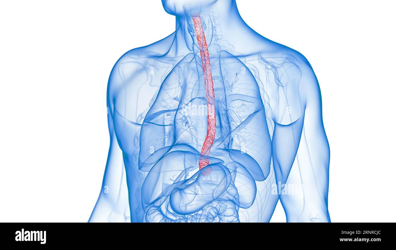 Inflamed oesophagus, illustration Stock Photo
