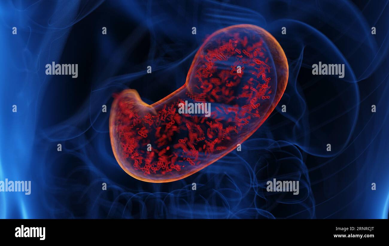 Stomach infection, illustration Stock Photo - Alamy