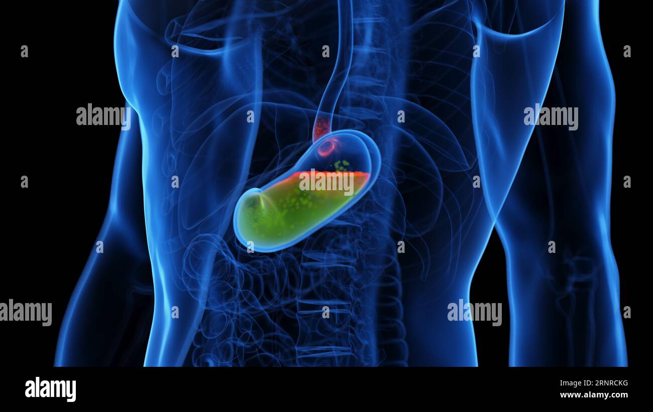 Gastroesophageal reflux disease, illustration Stock Photo Alamy