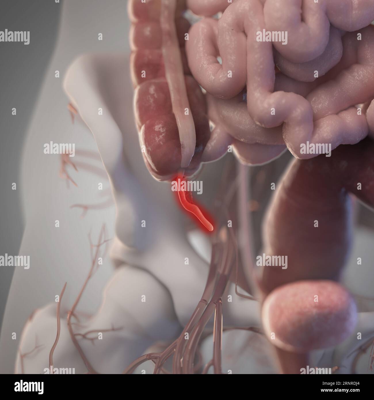 Normal appendix illustration hi-res stock photography and images - Alamy