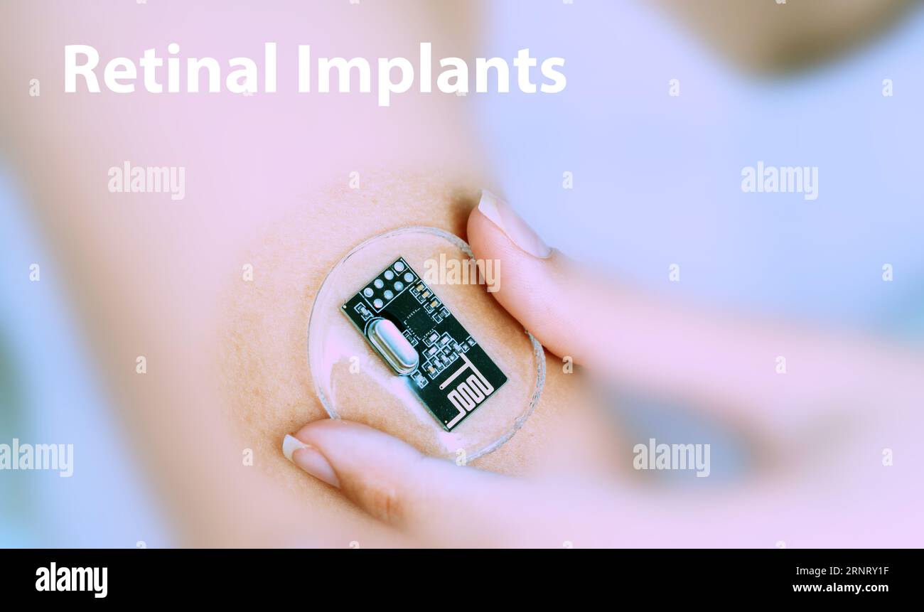 Retinal implants: Aid individuals with visual impairments by stimulating the retina to restore partial vision. Stock Photo
